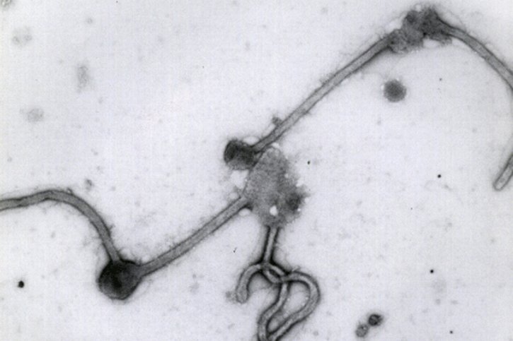 Le virus Ebola se transmet à l'homme par des animaux infectés (archives). © KEYSTONE/AP Antwerp Institute of Tropical Medicine