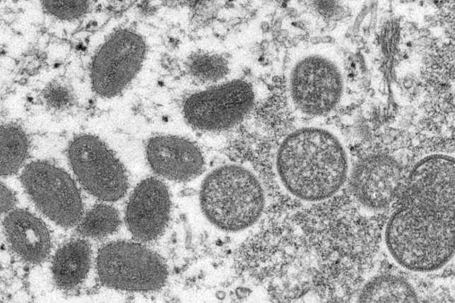 Deuxième cas suisse de variole du singe confirmé à Genève