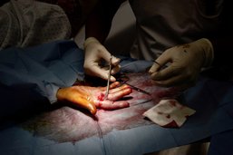 HFR: une certification pour la chirurgie de la main