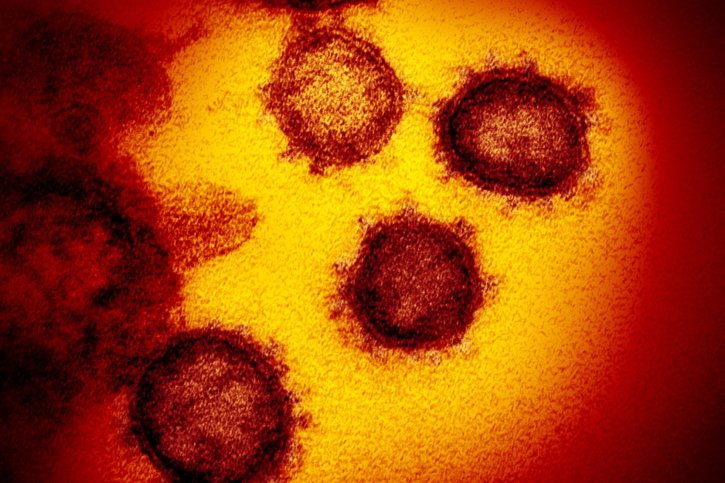 Le nouveau variant du coronavirus s'appelle BA.2.86 (archives). © KEYSTONE/EPA NATIONAL INSTITUTES OF HEALTH/NIAID- RML/NATIONAL INST